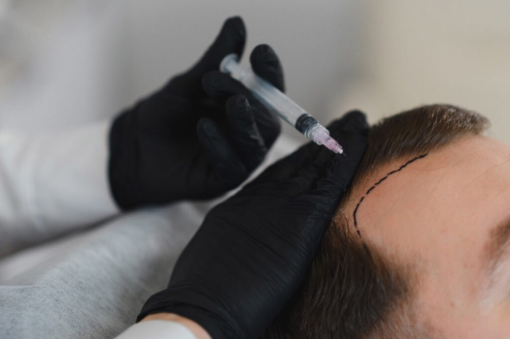 hair transplant singapore price